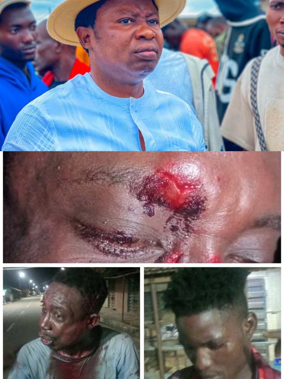 Enough Is Enough: End the Reign Of Political Violence In Ijesa Land Now